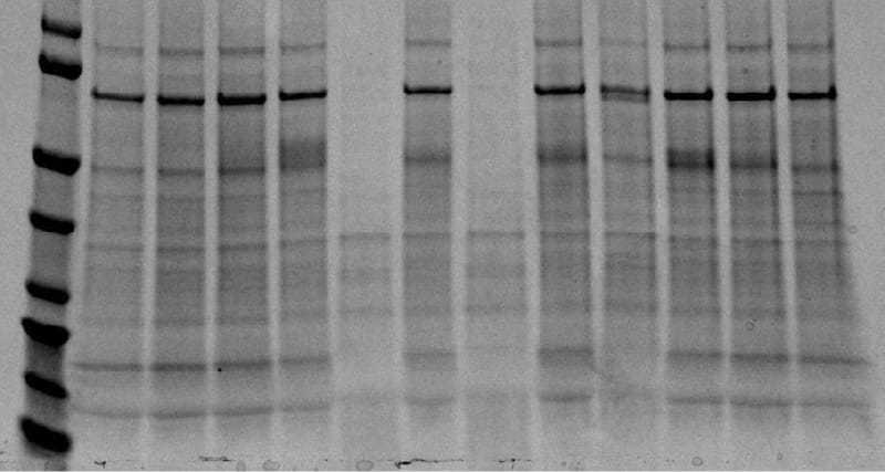 urc-after-gel