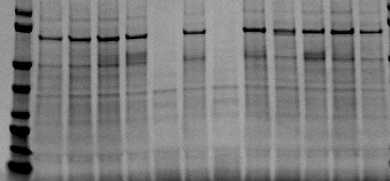 urc-before-gel